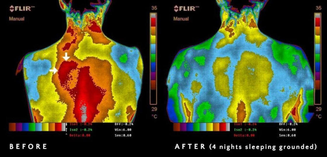 Thermal imaging showing inflammation before and after grounding
